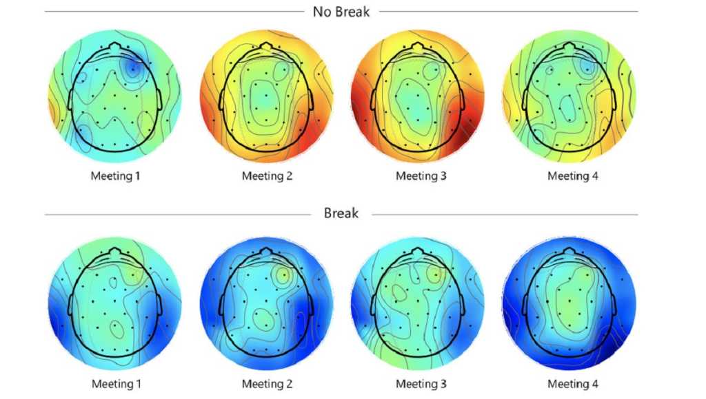 Brain scan break vs no break 100885348 orig.jpg